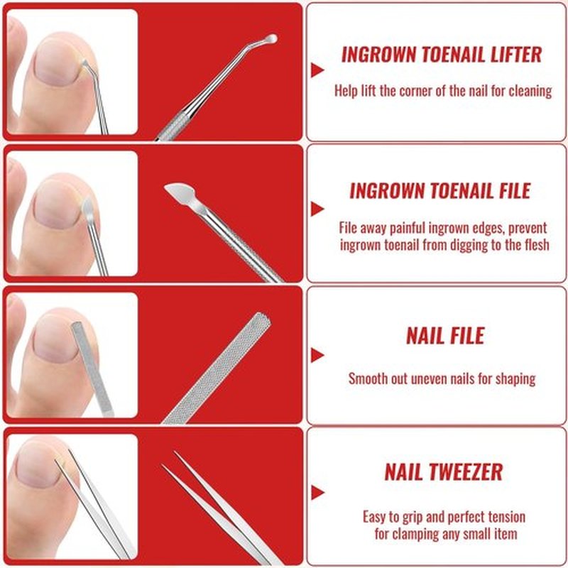 Ingrown Toenail Removal Kit, Ingrown Toenail Tool Kit with Ingrown Toenail Corrector, Ingrown Toenail Drops, Corrector Patch, Toenail Clipper, Nail File Lifter Tools