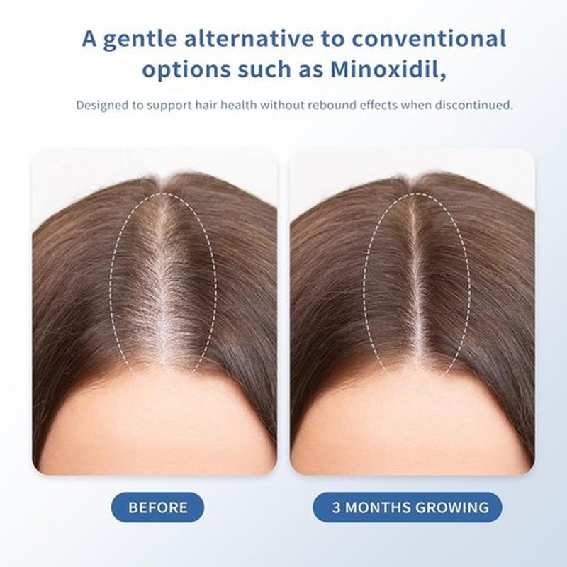 Hair Growth Serum for Thinning Hair | Strengthens & Thickens with Biotin | Fast-Absorbing Roll-On, No Rinse Needed (30ml)