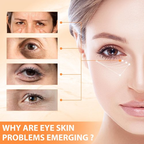 Tbexem Revive Glow Vitamin C Eye Balm - Hydrating Cream for Dark Circles & Puffiness (2PCS)