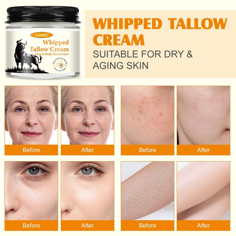 ZIXAOK Grass-Fed Tallow & Raw Honey Balm | Whipped Skin Cream for Face & Body | Soothes & Repairs Dry, Sensitive Skin | Organic, All-Natural Deep Hydration (2.1 oz)