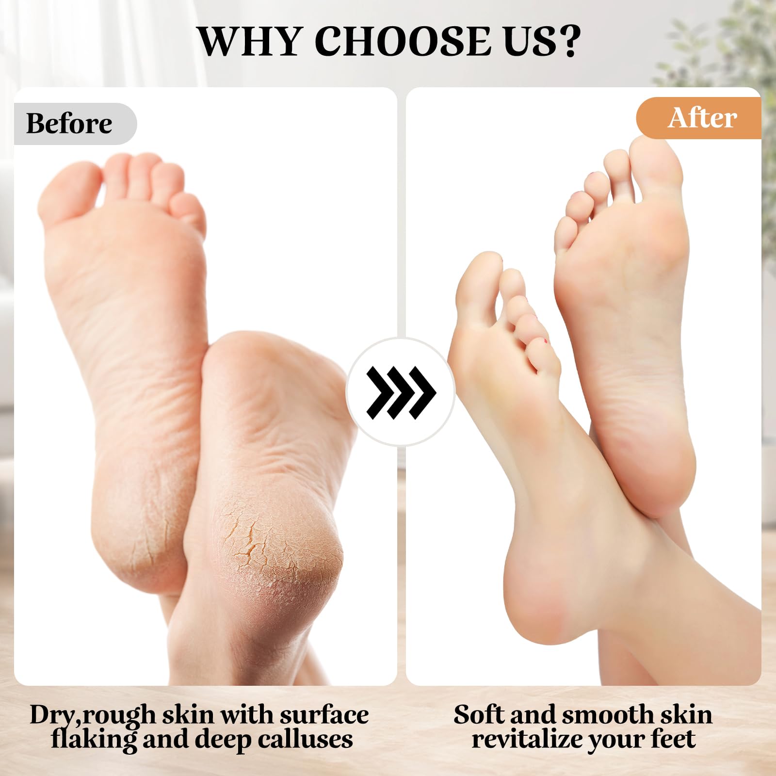 Electric Callus Remover Foot File - Rechargeable Callus Remover Pedicure Tools for Feet Foot Scrubber File Foot Care Grinder with 3 Grinding Heads 2 Speeds for Men Women Dry Callus Dead Skin (Blue)