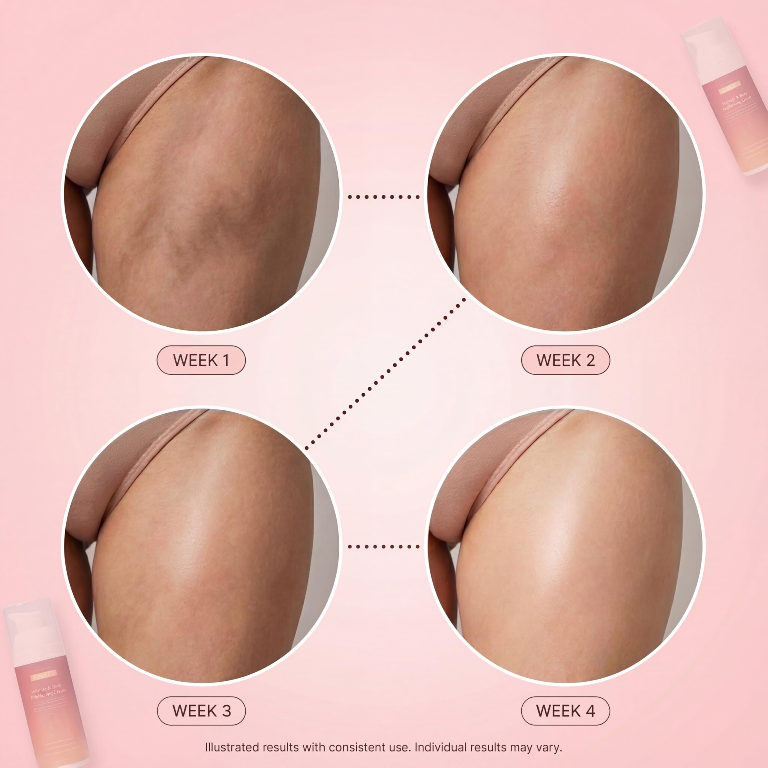 Hisery Body Brightening Cream for Uneven Skin Tone – Underarms, Knees, Elbows & Bikini Line, Niacinamide, Vegan
