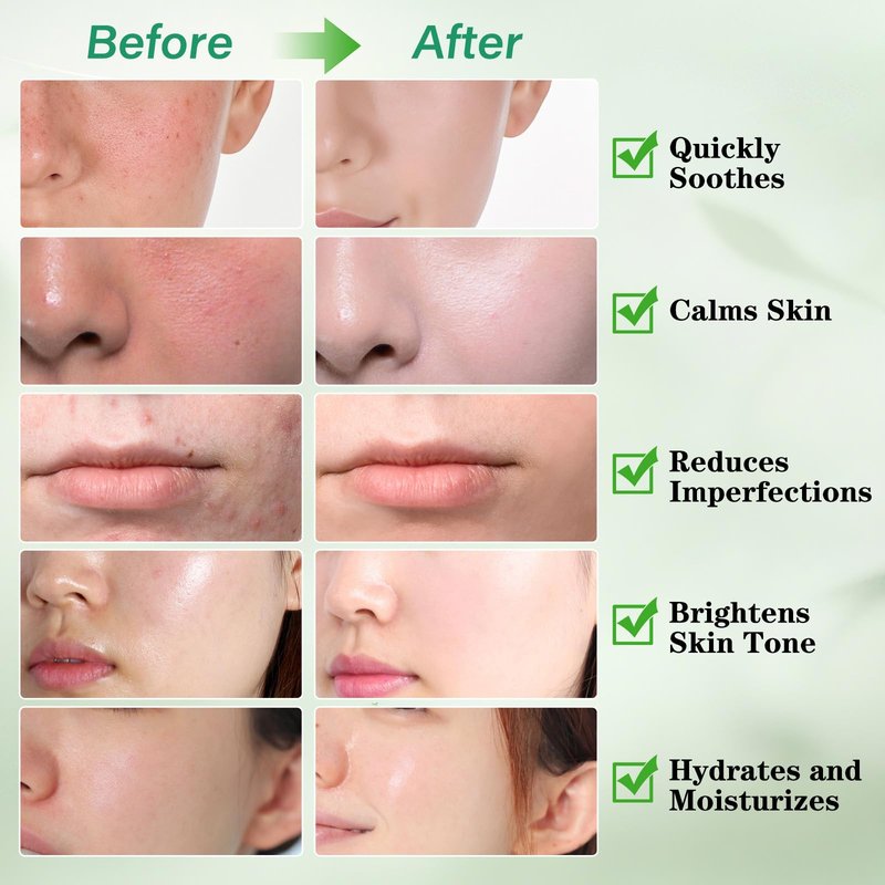 Madecassoside Blemish Pad, Pore Pad,Toner Pads for Face, Calm Redness, Strengthen Barrier & Brightens Skin Tone with Centella Asiatica, Vegan Gauze, 110 Pads for All Skin Types (110PADS)