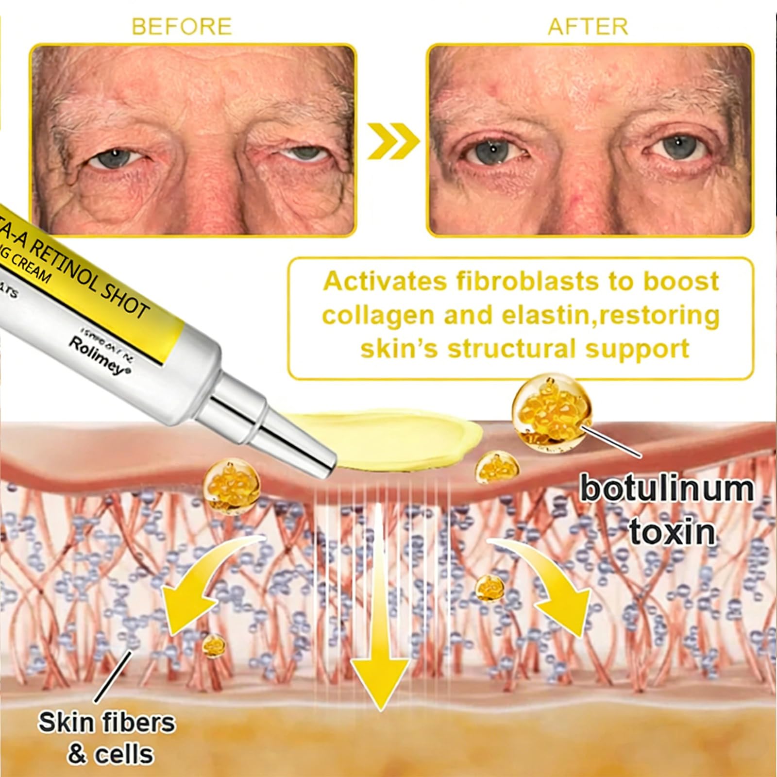 Rolimey Wrinkle-Liftt Botoxmix & Vita A Retinol Shot Tightening cream, Retinol Shot Wrinkle-Lift Tightening Cream, Lift and Tighten Skin, Deeply Moisturize (1PC)