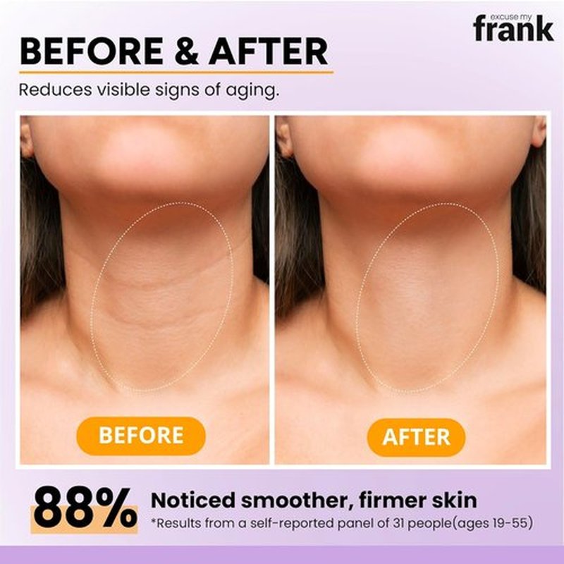 Excuse My Frank - Bakuchiol Age Defense Face & Neck Cream for Puffy Skin, Fine Lines & Dark Circles | 2 Pack