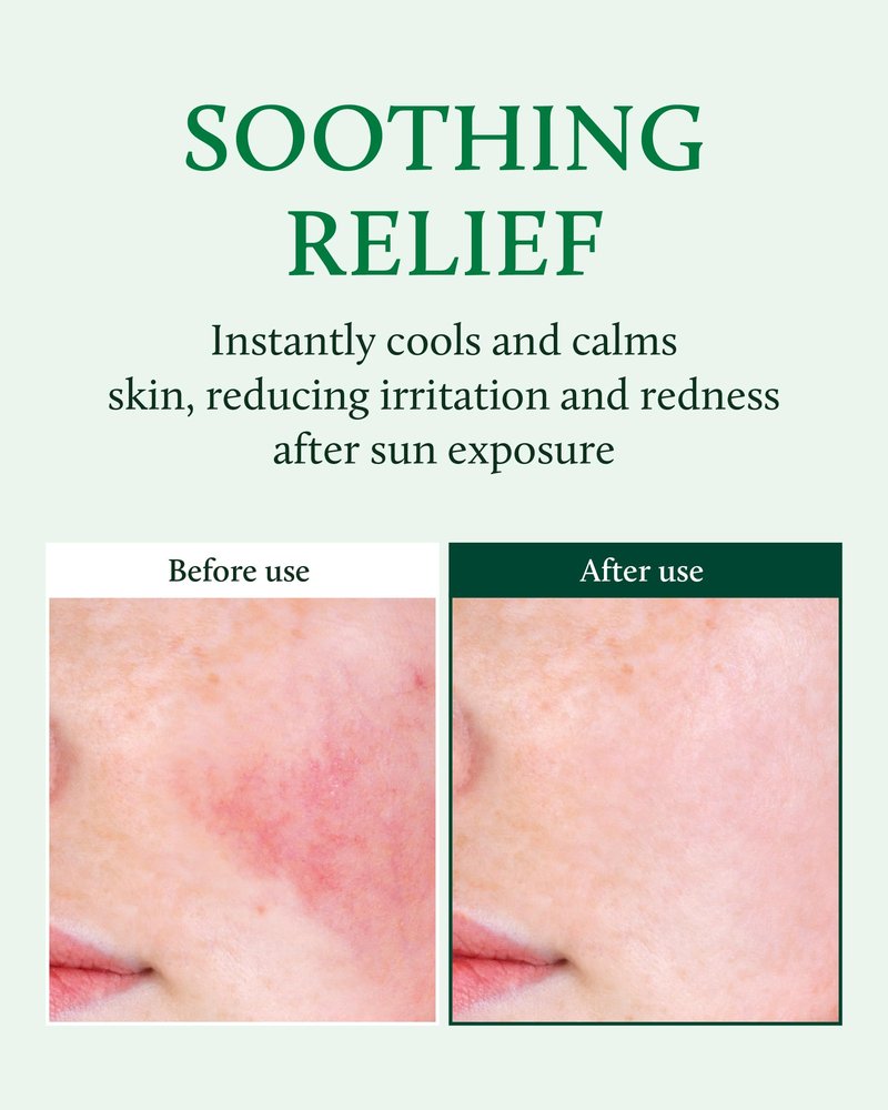 YADAH Cactus Soothing Gel (3.7fl oz) -95% Cactus Extract, Sunburn Relief,After Sun Care,Calm, Cool & Soothe Irritated Skin, Face Redness,Korean Skin Care,Vegan.