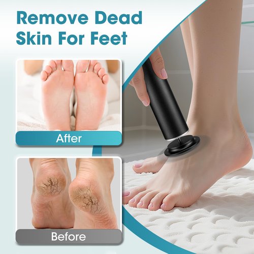 Electric Foot Callus Remover, Electric Callus Remover for Feet, Speed Adjustable Foot Sander Effortless Feet Skin Remover with 60pcs Replaceable Sandpaper Discs