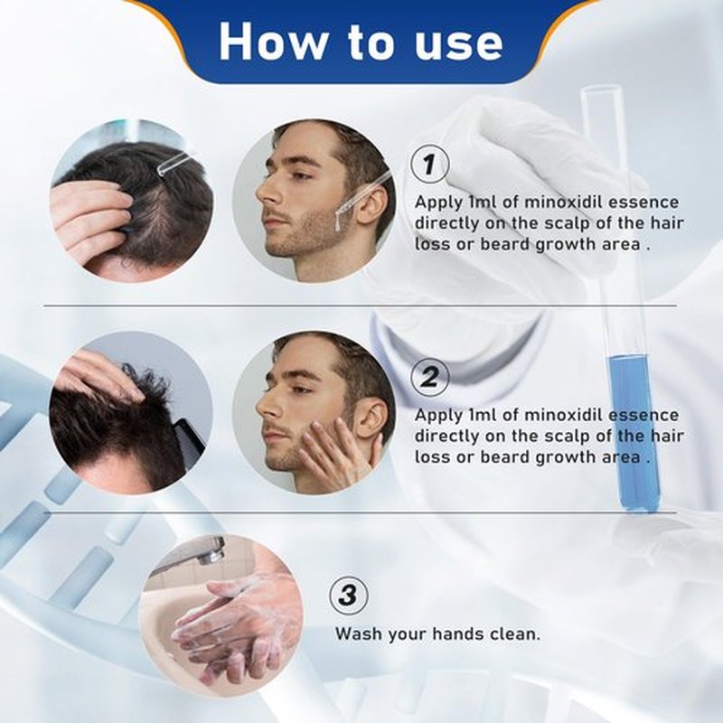 5% Minoxidil for Men Hair & Beard Growth Kit, Minoxidil for Women Hair Growth Serum, Extra Strength Hair Loss Treatment for Thinning Hair, Promotes Thicker Fuller Regrowth, Nourishes Scalp, 3 × 2oz