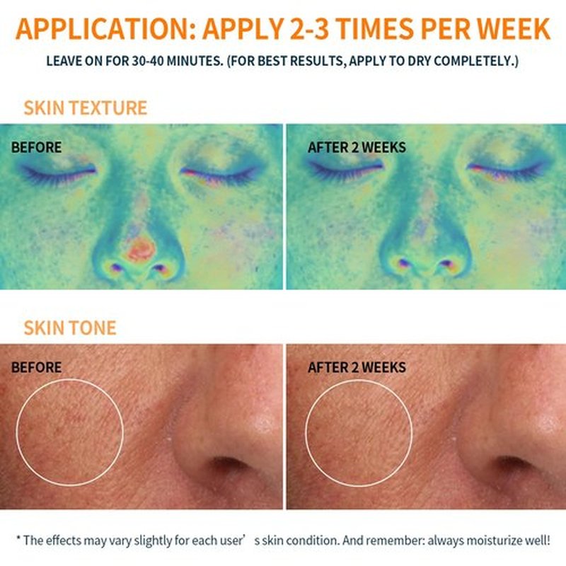 RAZUYEN Firming and Moisturizing Sheet Face Masks (Pack of 10) with Hyaluronic Acid and Peptides, Reduce Fine Lines and Wrinkles, Hydrating & Anti-Aging Spa Face Mask, Facial Skin Care
