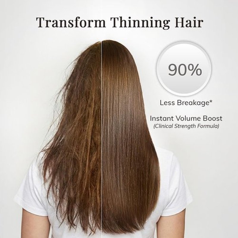 RootStim Rosemary Conditioner - Hair Growth & Thinning Treatment with Saw Palmetto & Keratin | 10 fl oz