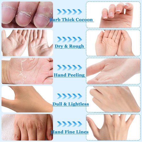 Permotary Moisturizing Hand Mask Gloves for Dry Skin, 6 Pairs, Milk Scented