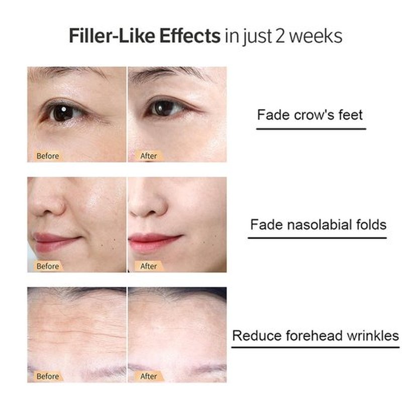Skiennix Deep Collagen Anti-Wrinkle Serum - 30ml Hyaluronic Acid Moisturizer for Smooth, Youthful Skin