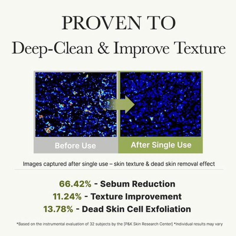 ARENCIA Salicylic Acid Cleanser - Deep Pore Cleansing Face Wash with Green Tea & LHA, 5.07 fl oz