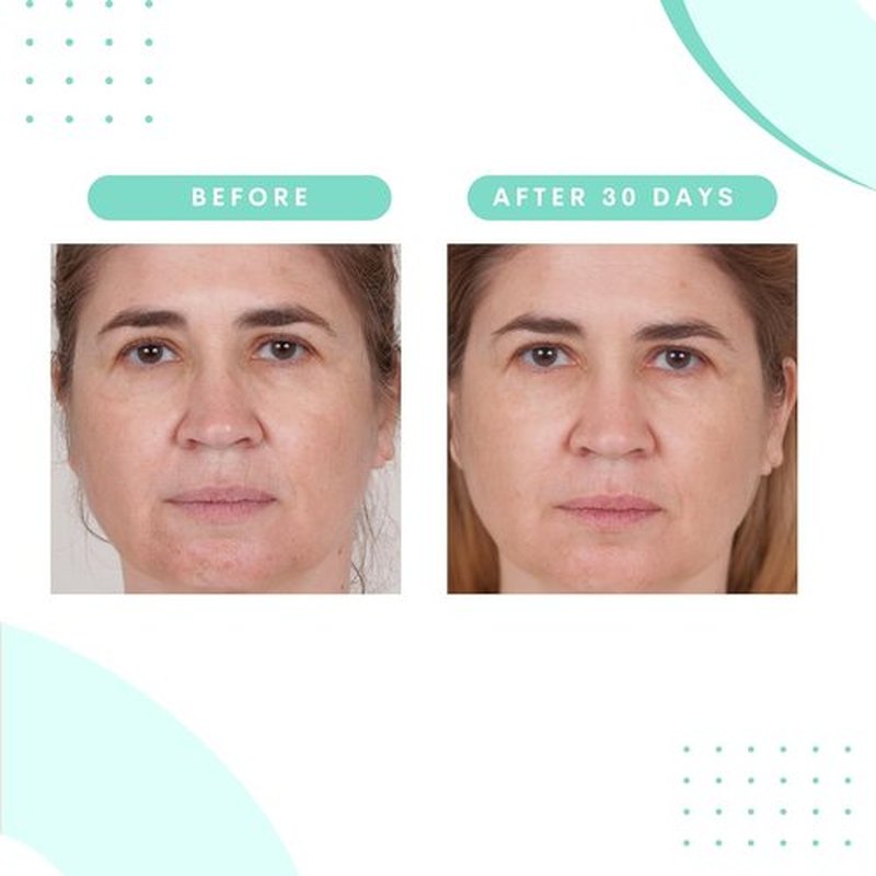 Serious Skincare Glycolic Acid Treatment Pads - Exfoliating Face Discs for Fine Lines & Wrinkles | 2 Pack (60 Pads Each)
