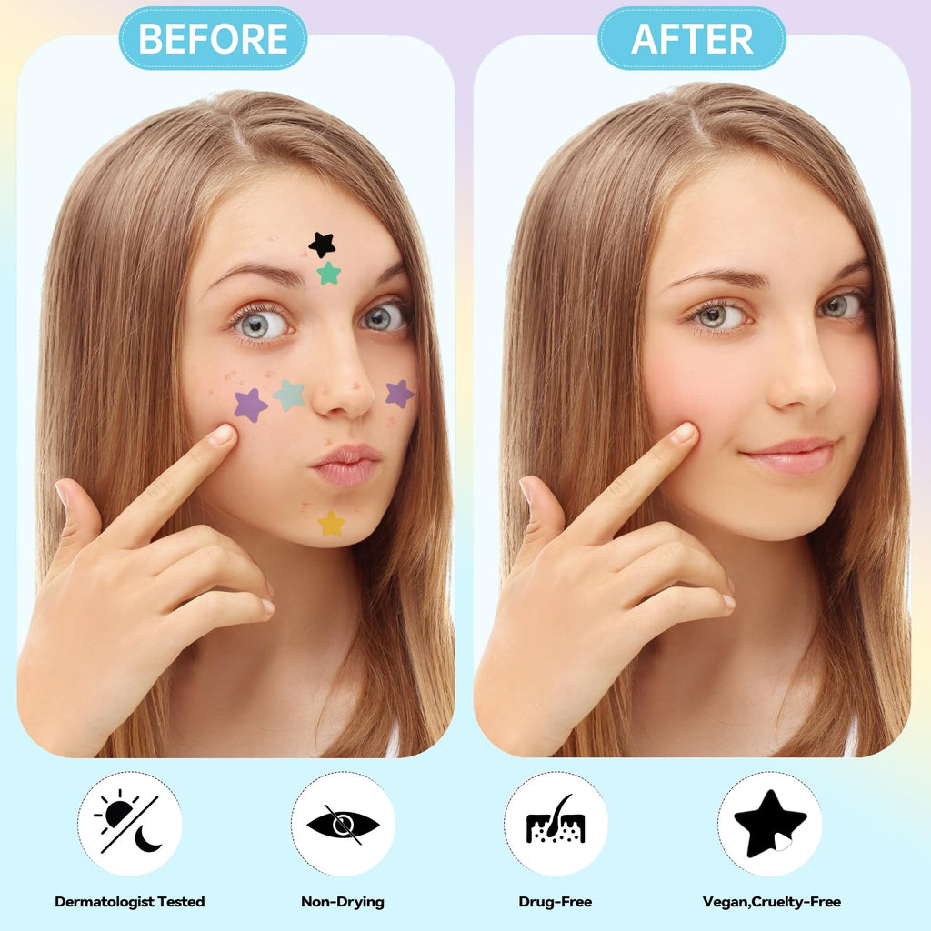 Waspot Pimple Patches for Face, Cute Star Zit Covers, Stars Hydrocolloid, For Sensitive Skin, with Tea Tree, Salicylic Acid & Cica Oil (10&12&14mm) 240 Count