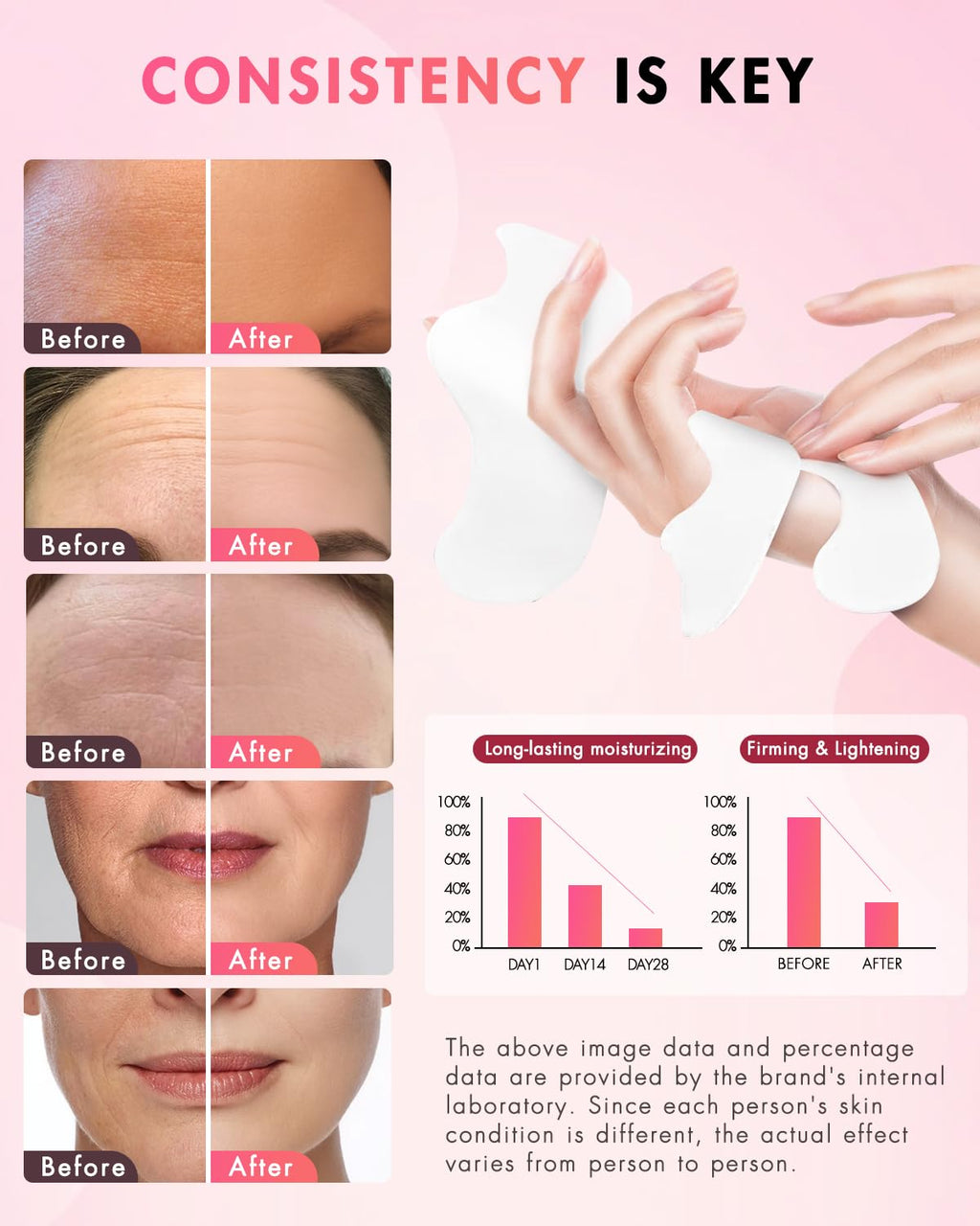 UKVOA Forehead and Smile Line Patches, Overnight Facial Wrinkle Treatment with Hyaluronic Acid, Aloe, Collagen & Vitamin E to Lift Smile Lines for Women 36pcs