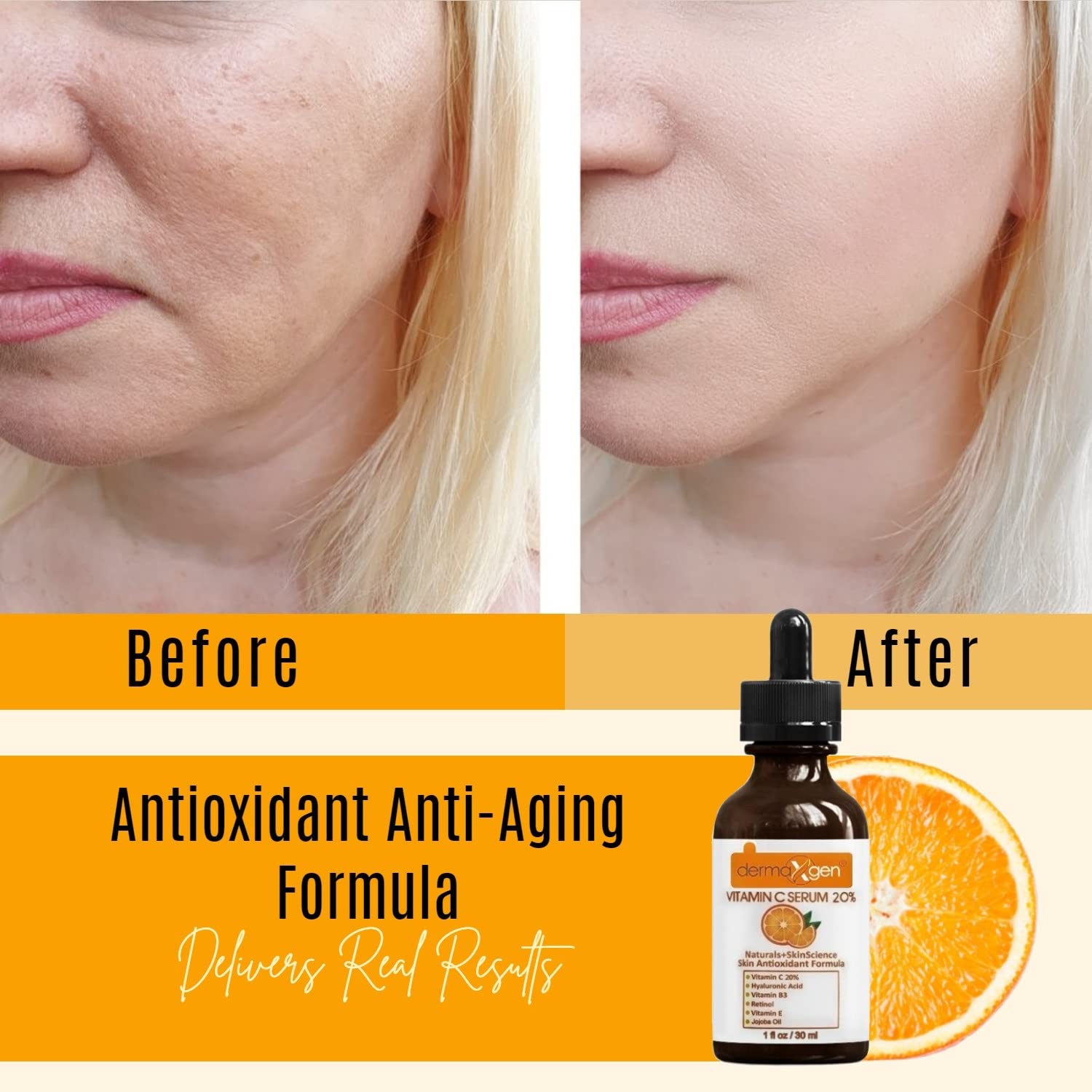 DERMAXGEN Organic 20% Vitamin C Serum for Face (01 Fl oz)