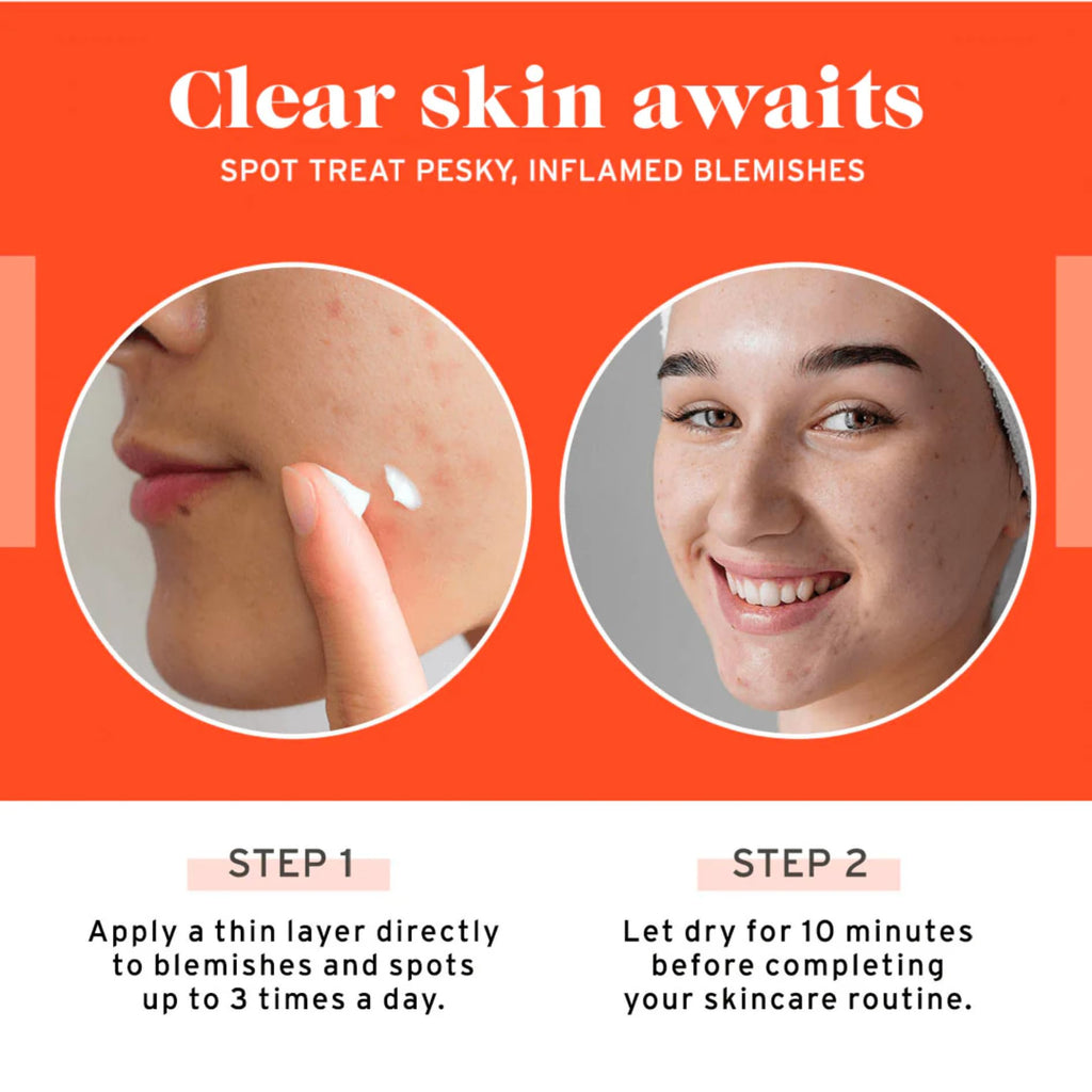 No Bad Stuff - Acne Spot Treatment - Acne Control with 2% Salicylic Acid, Fades Blemishes, with Chamomile, Aloe Vera & Vitamin E (0.5 oz)