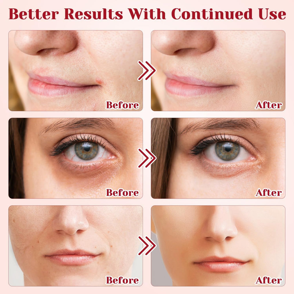 Dragons Blood Easy Cream, Retinol & Plant Extract Dragon Blood Cream, Moisturizer Nourishing Rejuvenating Cream (2pcs)