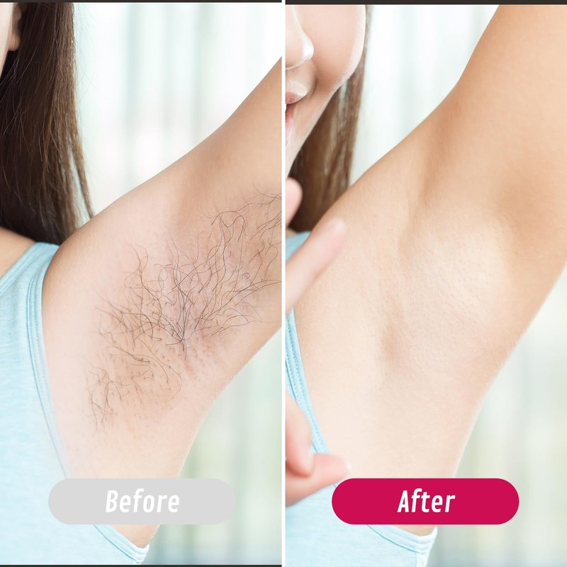 Roll On Wax Kit, Portable Wax Roller Kit for Coarse/Fine Hair Removal, Beginners Waxing Roller for All Skin Types with 3 Pcs 100g Roll Cartridge, 100 Non-Woven Strips & 10 After Oil Wipes (F3_Pink)
