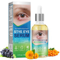 Stye Eye Relief Serum Natural Eyelid Drops for Styes Blepharitis & Chalazion Fast-Acting Relieve Eye Irritation Redness & Swelling Gentle Formula 1.01 Fl oz/30 Ml