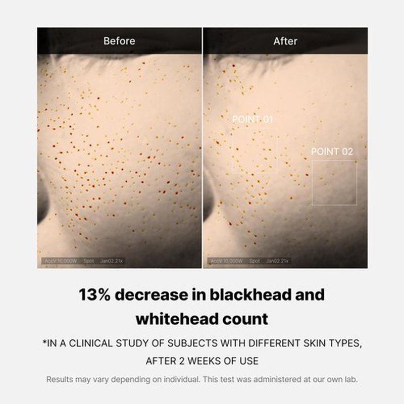 Medicube Zero Pore One-day Serum 1.01 fl.oz - Overnight Resurfacing Serum with Pore Tightening Complex - 15.2% AHA+BHA+PHA & 2% Niacinamide - 10.8% reduction in pore appearance after one day of use