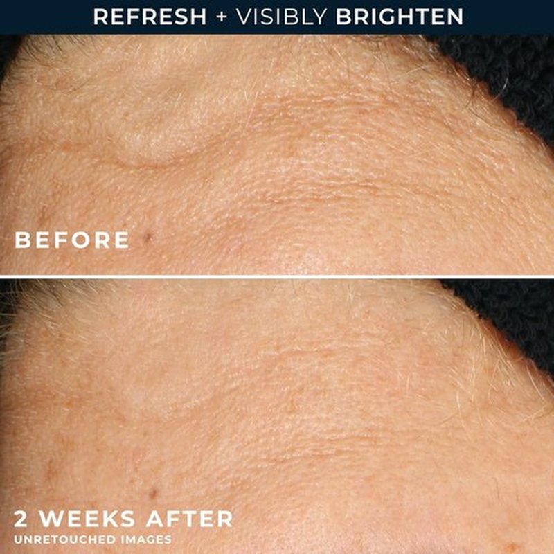 RoC Multi Correxion Revive + Glow Gel | Vitamin C Facial Cleanser with Glycolic Acid - 6 Ounces