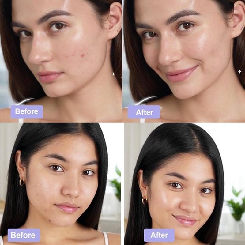 Madecassoside Toner Pads, Mild Exfoliating Pads, Calming Blemish Face Pad -Centella, Niacinamide, BHA Salicylic Acid for Soothe, Uneven Skin Tone, Dark Spots, Skincare 125 Pad