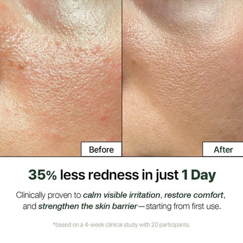 Natural Derma Project NDP Cica Cream - Lightweight Gel Face Moisturizer for Sunburn Relief | 1.7 Fl Oz (50ml)