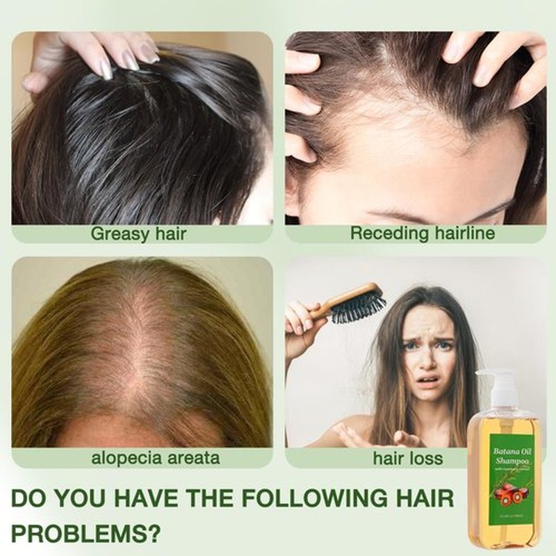 Shampoo De Batana, Rosemary Oil Shampoo De Batana Para La Caida Del Cabello, Nourishing & Regenerating Hair-Soft and Fluffy for Men & Women (1pcs)
