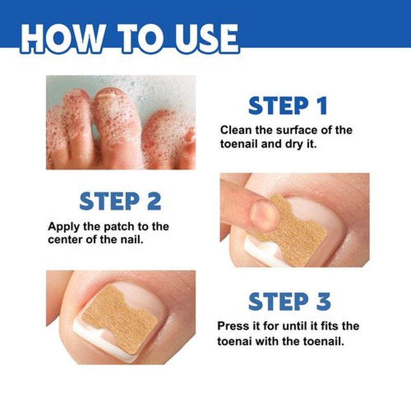 20 Patches Fungal Nail Repair for Toenail Restoration, Treats Thick, Damaged, Discolored or Falling Off Toenails, 8-Hour Intensive Treatment, Includes Nail Care Bandages