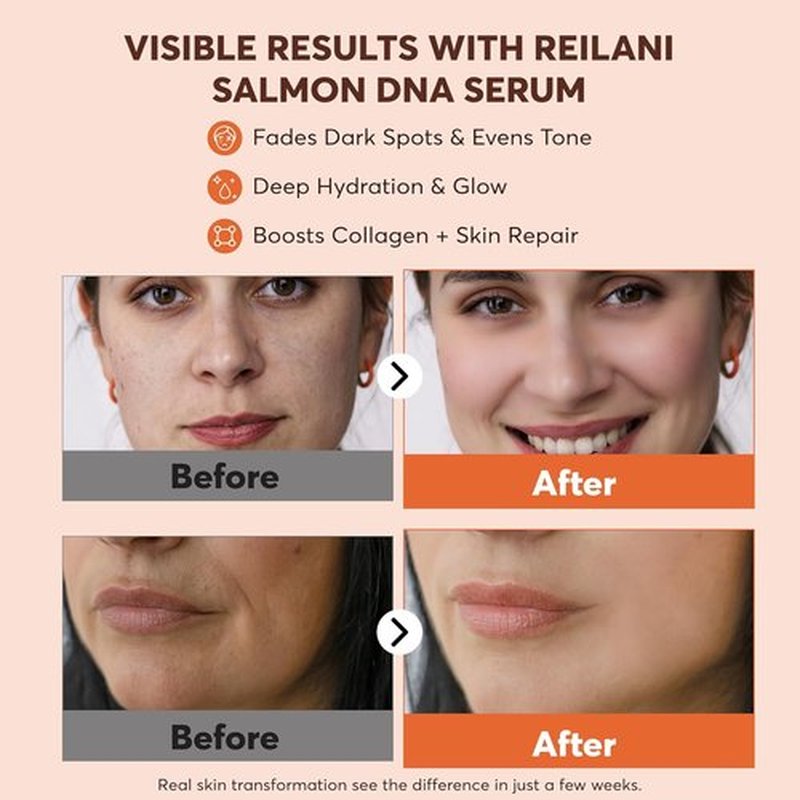 PDRN Salmon DNA Serum - Anti-Aging Hydrating Face Serum with Hyaluronic Acid & Vitamins - 1 Fl Oz