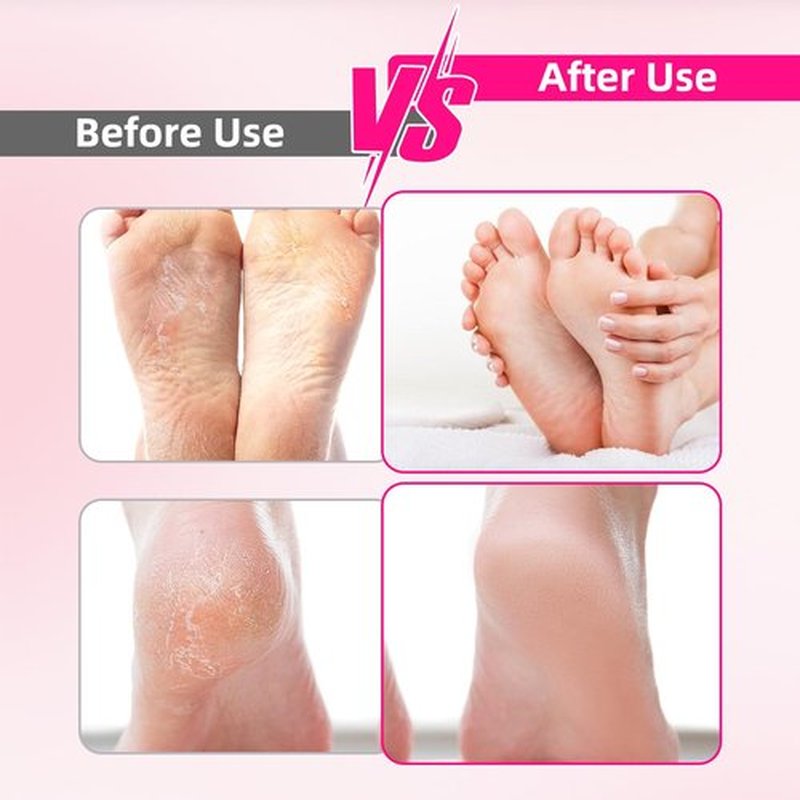 Electric Foot File Callus Remover - 3 Speeds & 4 Nano Glass Heads for Smooth Feet - Professional Pedicure Tool for Dead Skin Hard & Cracked Heels - Rechargeable & Portable