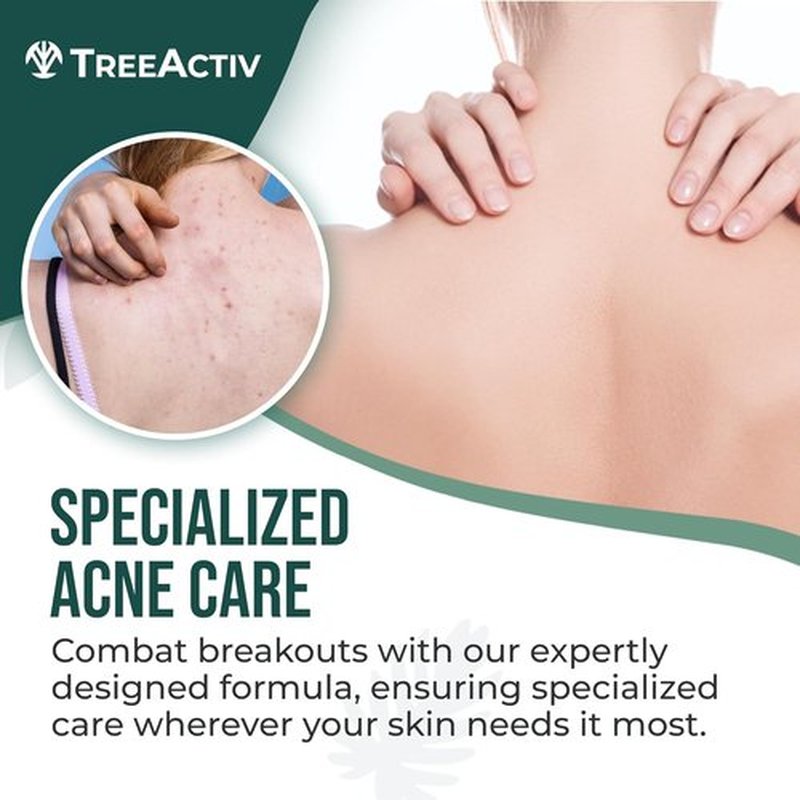 Back Acne Spray by [Brand Name] - Fast-Drying 2% Salicylic Acid & Tea Tree Oil Mist | 4 fl oz
