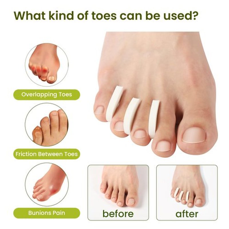 Bukihome 50 Pack Foam Toe Separators - Correct Overlapping Toes and Reduce Friction - Breathable and Comfortable, Foam Toe Spacers for Women
