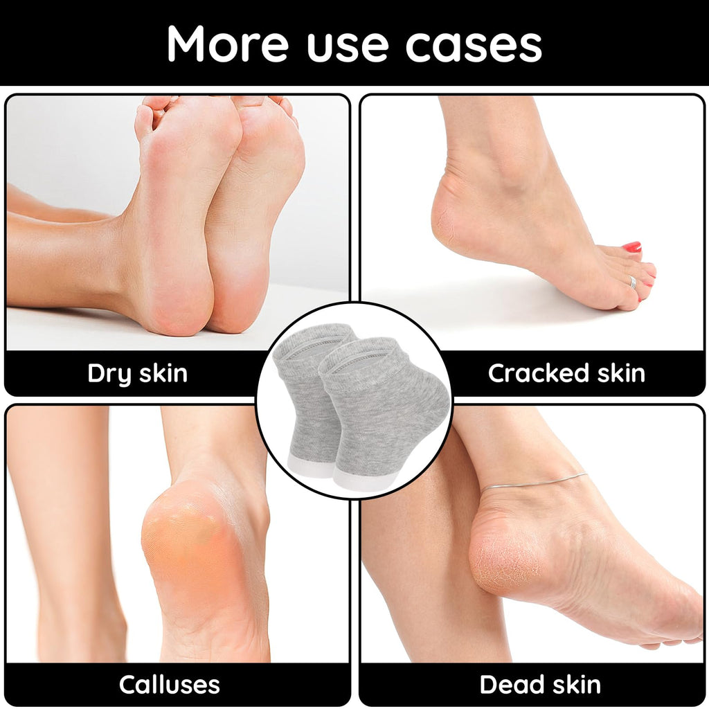 Segbeauty 16pcs Lotion Socks for Dry Feet Overnight, 8 Pairs Moisturizing Heel Gel Socks for Dry Feet Cracked Heel, Foot Care Feet SPA Socks for Men and Women, Open Toe Foot Socks Sleeping Overnight