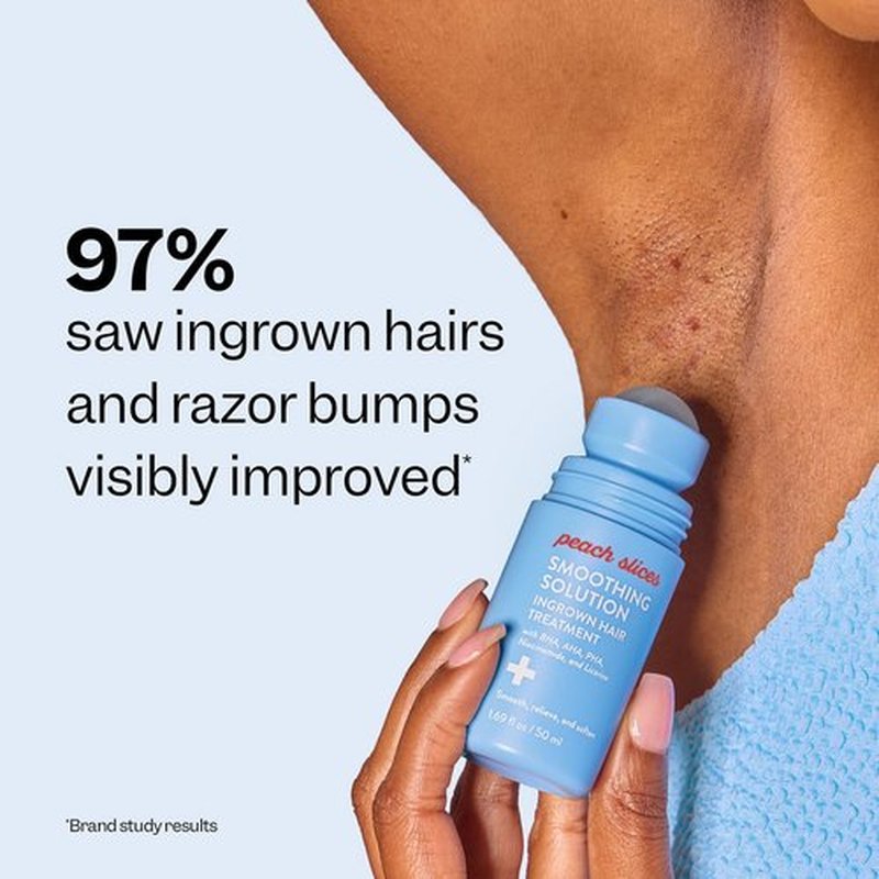Peach Slices Ingrown Hair Treatment - Smoothing Solution with 360 Roller (1.69 oz) | Vegan & Cruelty-Free