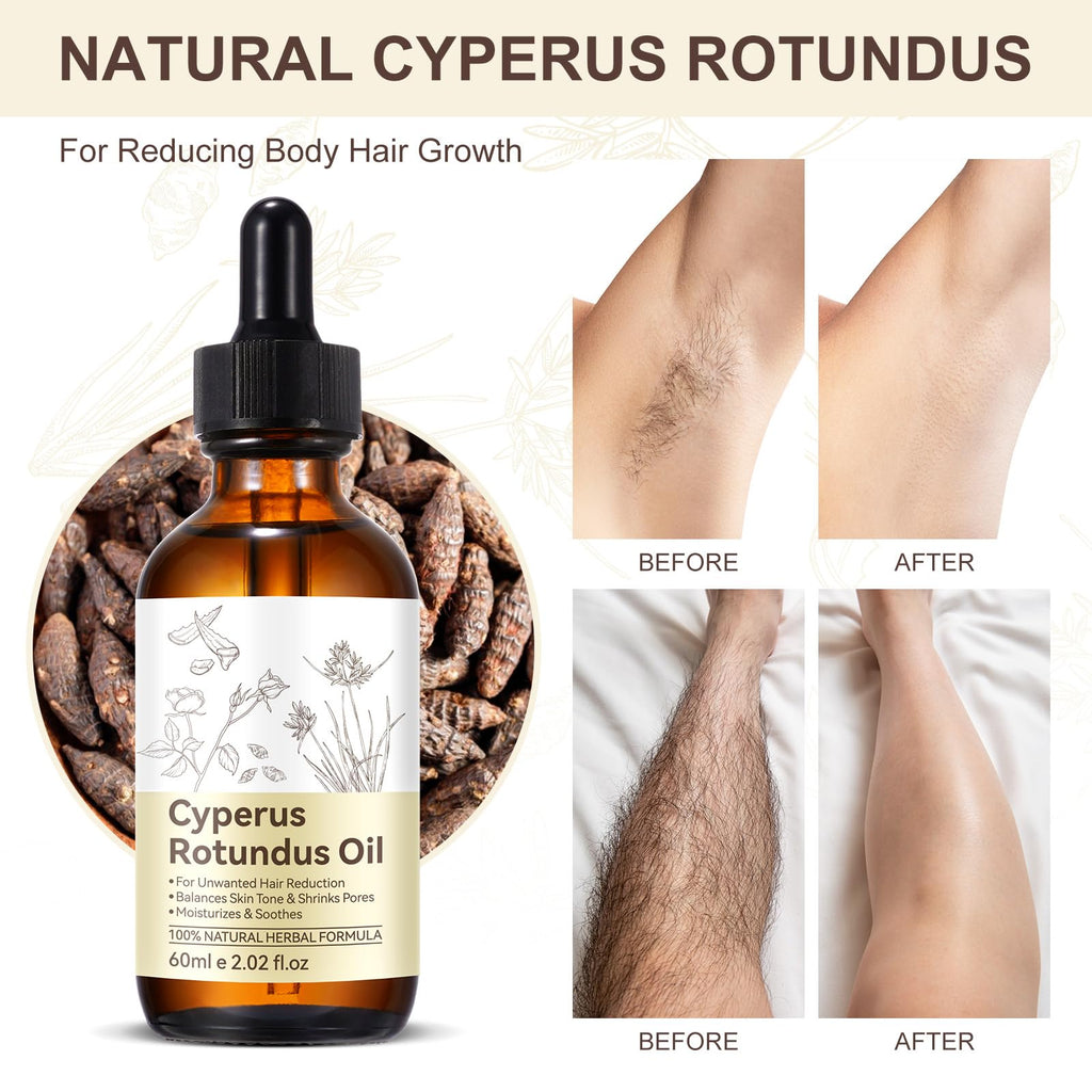 ZIXAOK Natural Cyperus Rotundus Oil for Hair Reduction | Slows Unwanted Body Hair Growth on Face, Arms, Bikini Line | Balances Skin Tone & Moisturizes | 100% Pure, All Skin Types | 2.02 Fl Oz