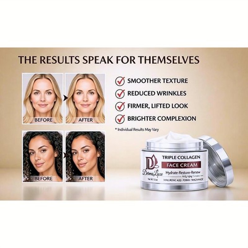 Triple Collagen Face Moisturizer – Retinol-Free Anti-Aging Cream for Sensitive Skin with PDRN (Salmon DNA) & Hyaluronic Acid – Firming & Wrinkle Smoothing, Fragrance-Free, 1.7 oz