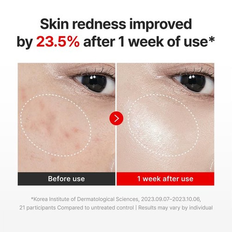 CENTELLIAN 24 Madeca Cream Time Reverse (1.69fl oz) - Advanced Fast-Absorbing & Nourishing, Hydrates, Firms & Reduces Wrinkles, Low Irritation, Korean Skin Care Centella Asiatica, Collagen