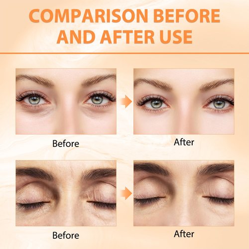 Tbexem Revive Glow Vitamin C Eye Balm - Hydrating Cream for Dark Circles & Puffiness (2PCS)