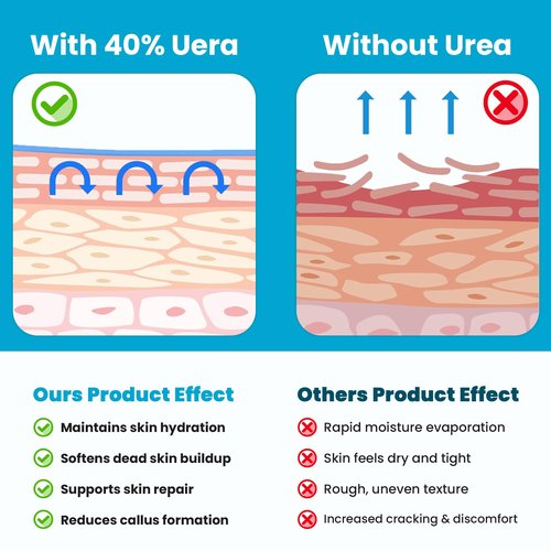 Miratiful Urea Cream 40% plus Salicylic Acid 2% (4 oz)| Urea Cream For Feet Dry Cracked Heels, Knees, Elbows, Hands Callus&Corn Treatment | Urea Foot Cream 40 Percent w/Tea Tree & Coconut Oil
