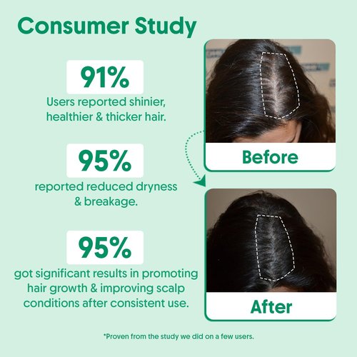 Aravi Organic Rosemary Water Hair Spray with Aloe Vera & Rice Water | Stimulates Hair Follicles, Boosts Hair Growth & Thickness, Reduces Hair Fall, Breakage & Dandruff | For Men & Women - 100ml