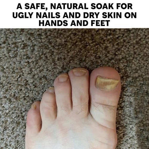 Long Creek Herbs Nail Soak - 100 Percent Natural Hand and Foot Soak - Strengthens Nails and Softens Skin - Relieves Dryness and Cracked Heels