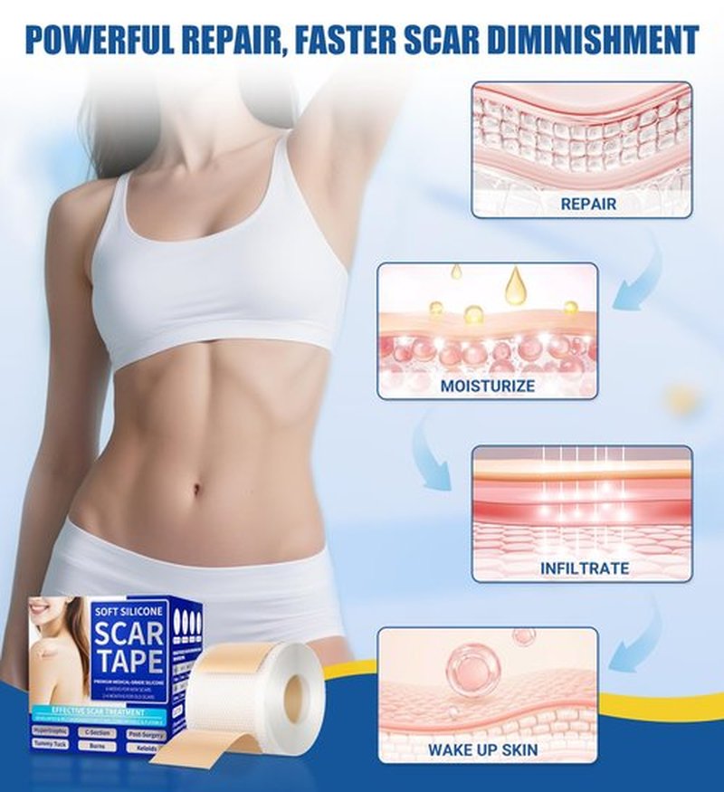 MasterMo Medical Grade Silicone Scar Sheets & Tape - 1.6”x120“ Roll, Ultra Soft, Hypoallergenic Rolls for Surgical, C-Section, Tummy Tuck, Keloid Scars, Stretch Marks & Burn Scar Removal