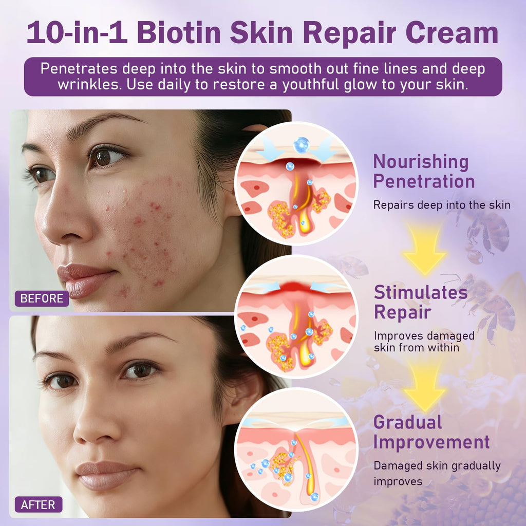 Biotin 10-in-1 Skin Restoration Cream, 2026 New Professional Skin Treatment Cream, Evolvion Natural Ingredient Skin Cream, Moisturizer, Natural Collagen Lifting Serum for All Skin Types(2PCS)