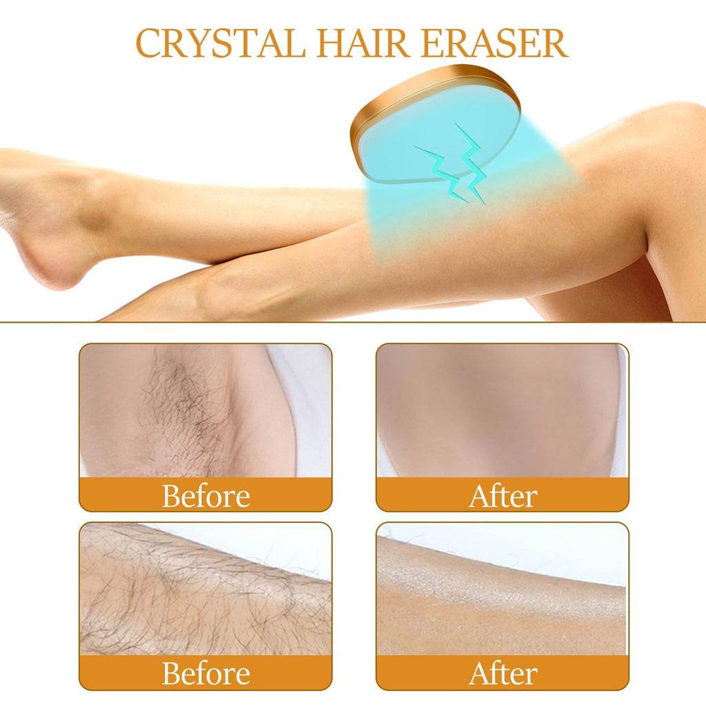 Crystal Hair Eraser, Painless Hair Removal Tool, Reusable Hair Remover for All Body Parts (Gold)