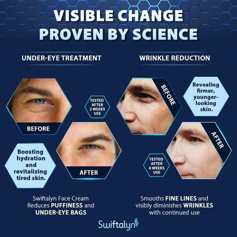 Swiftalyn 6-in-1 Face Cream for Men: Men's Face Moisturizer Anti-Aging Cream, Dark Spot & Eye Bag Treatment, Reduces Wrinkles – Men's Skincare