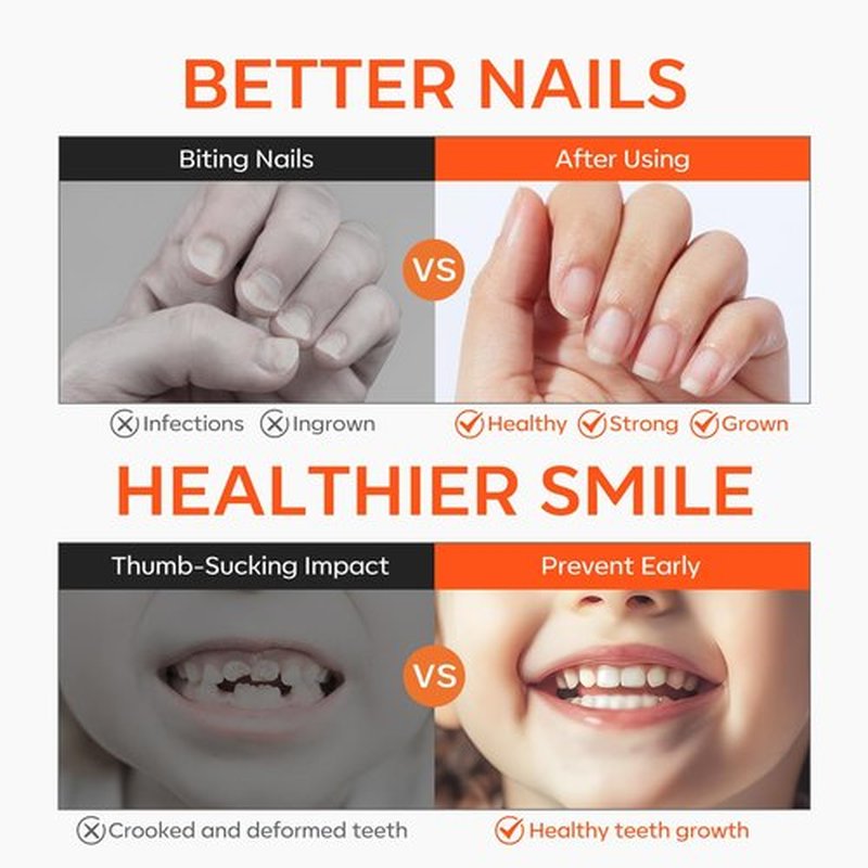 modelones Nail Biting Treatment for Kids 2 Pcs Nail Biting Prevention for kids Quick Dry Thumb Sucking Deterrent Bitter Stop Nail Biting Pen No Bite Nail Polish Sets 0.58 Fl Oz