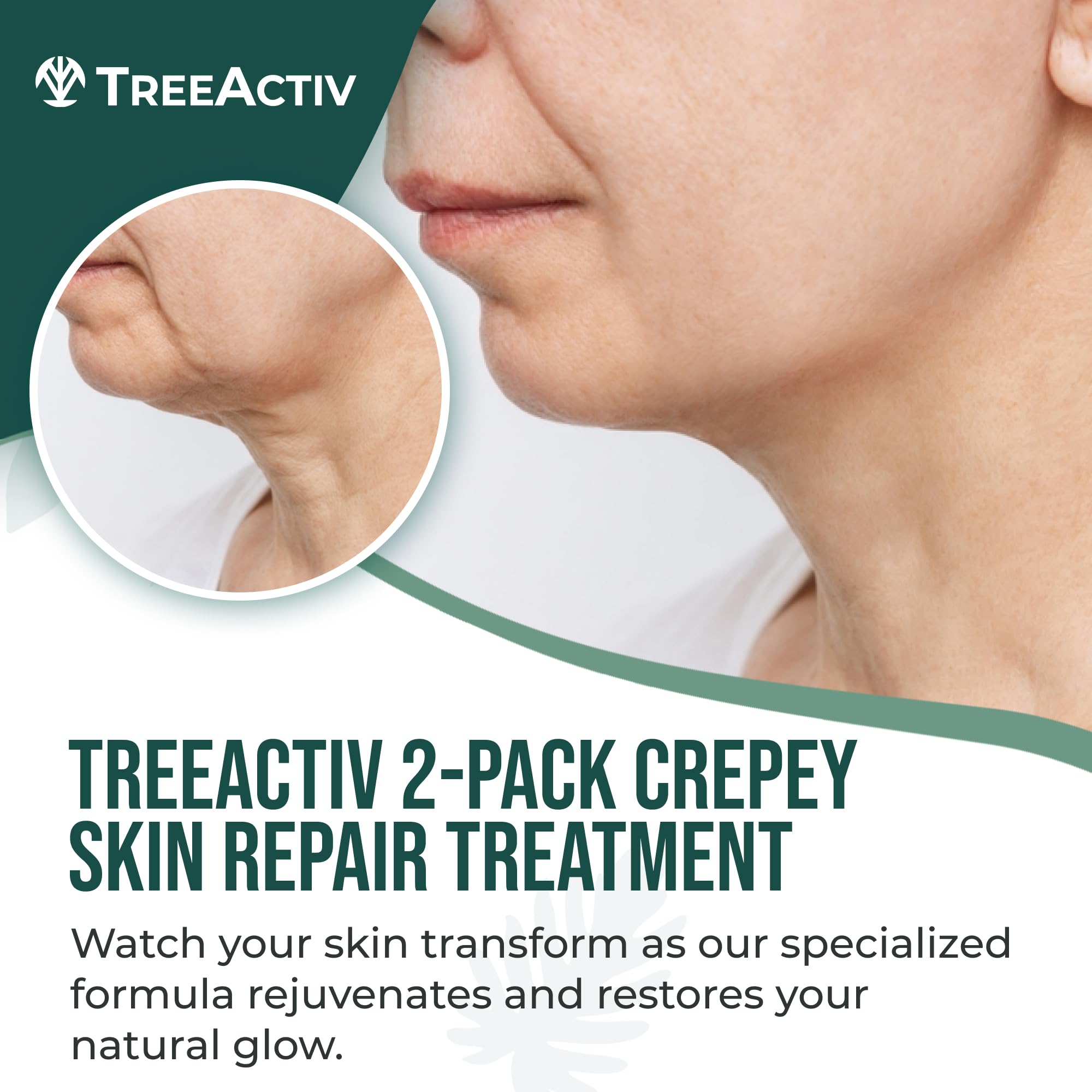 TreeActiv Crepey Skin Repair Cream, 2-Pack, Firming Cream For Face and Neck, Skin Firming and Tightening Lotion with Hyaluronic Acid, Designed to Hydrate Dry, Crepey-Looking Areas, 1000+ Uses